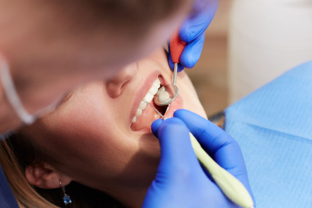 Doctor reviewing a patient's mouth