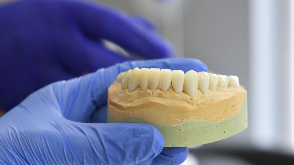 Dental Crowns in South Holland, IL Costs, Process & What to Expect