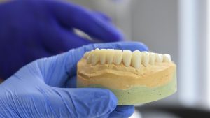 Dental Crowns in South Holland, IL Costs, Process & What to Expect