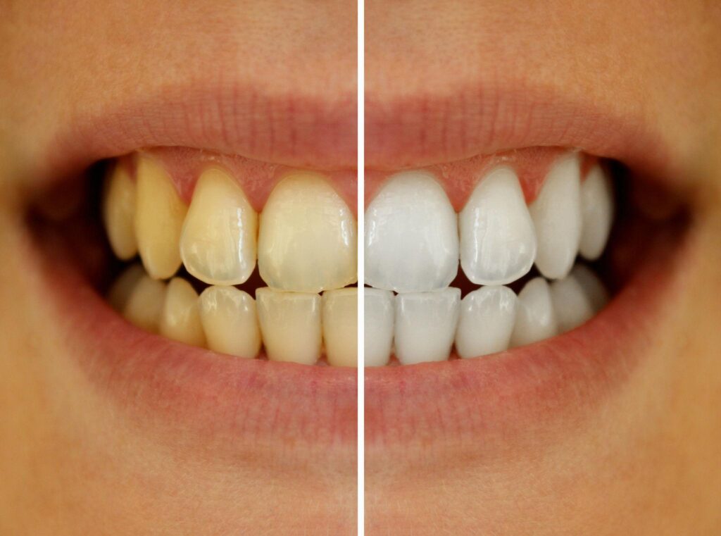 Stains, Aging, and What's Reversible
