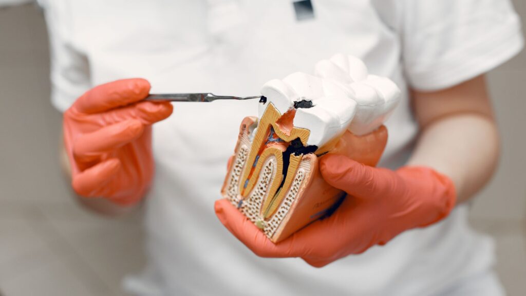 Do You Need a Root Canal Before a Crown